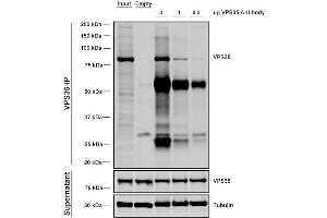 Immunoprecipitation analysis using Mouse Anti-VPS35 Monoclonal Antibody, Clone 11H10 (ABIN6933004). (VPS35 抗体)