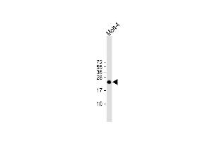 All lanes : Anti-ORMDL3 Antibody (Center) at 1:1000 dilution Lane 1: Molt-4 whole cell lysate Lysates/proteins at 20 μg per lane. (ORMDL3 抗体  (AA 53-81))