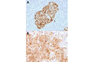 Immunohistochemical staining (Formalin-fixed paraffin-embedded sections) of human pancreas (A) and human parathyroid (B) with CHGA recombinant monoclonal antibody, clone CHGA/1731R . (Recombinant Chromogranin A 抗体)