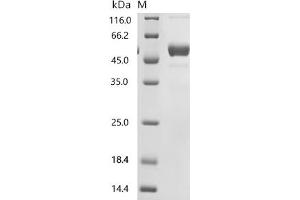(Tris-Glycine gel) Discontinuous SDS-PAGE (reduced) with 5 % enrichment gel and 15 % separation gel.