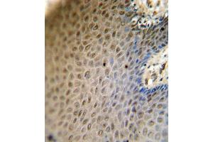 Immunohistochemistry (Paraffin-embedded Sections) (IHC (p)) image for anti-Sterol Regulatory Element Binding Transcription Factor 2 (SREBF2) (AA 399-427) antibody (ABIN654630)