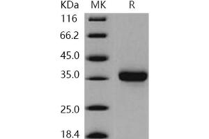 Western Blotting (WB) image for Kallikrein 8 (KLK8) (Active) protein (His tag) (ABIN7196673)