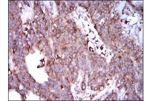 Immunohistochemistry (IHC) image for anti-Signal Transducer and Activator of Transcription 5A (STAT5A) (AA 583-794) antibody (ABIN1845625) (STAT5A 抗体  (AA 583-794))