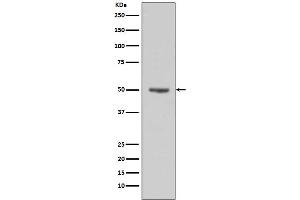 Western blot analysis of Cyclin E1 expression in HeLa cell lysates.