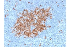 Formalin-fixed, paraffin-embedded human Tonsil stained with Thymidylate Synthase Mouse Monoclonal Antibody (TYMS/1884).