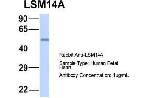 Host: Rabbit  Target Name: LSM14A  Sample Tissue: Human Fetal Heart  Antibody Dilution: 1. (LSM14A 抗体  (C-Term))