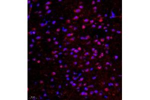 Immunofluorescence of paraffin embedded mouse brain using ghrelin (ABIN7074040) at dilution of 1:500 (400x lens) (Ghrelin 抗体)