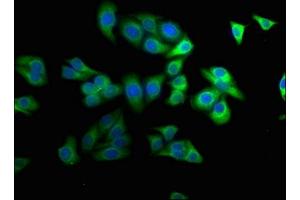 Immunofluorescence staining of HepG2 cells with ABIN7169172 at 1:100, counter-stained with DAPI. (Sbk2 抗体  (AA 62-330))