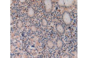 Used in DAB staining on fromalin fixed paraffin- embedded stomach tissue (VPREB1 抗体  (AA 33-135))