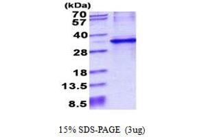 SDS-PAGE (SDS) image for Cytochrome B5 Reductase 1 (CYB5R1) (AA 29-305) protein (His tag) (ABIN5852942) (CYB5R1 Protein (AA 29-305) (His tag))