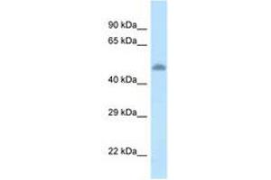 Image no. 1 for anti-tyrosine Aminotransferase (TAT) (AA 361-410) antibody (ABIN6747577) (TAT 抗体  (AA 361-410))