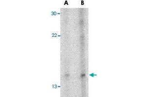 Western blot analysis of NRN1 in Daudi cell lysate with NRN1 polyclonal antibody  at (A) 5 and (B) 10 ug/mL . (NRN1 抗体  (Internal Region))