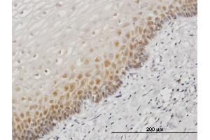 Immunoperoxidase of monoclonal antibody to HSPA1B on formalin-fixed paraffin-embedded human esophagus. (HSPA1B 抗体  (AA 531-611))