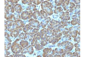Immunohistochemistry (IHC) image for anti-Topoisomerase (DNA) I, Mitochondrial (TOP1MT) antibody (ABIN6939147)