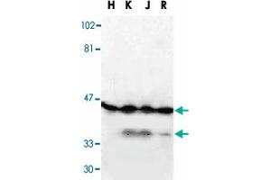 Western blot analysis of DFFA in HeLa, (H), K-562 (K), Jurkat (J), and Raji (R) whole cell lysate with DFFA polyclonal antibody  at 1 : 1000 dilution. (DFFA 抗体  (AA 2-21))
