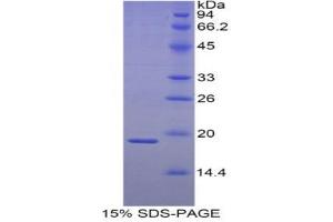 SDS-PAGE (SDS) image for Heat Shock 27kDa Protein 3 (HSPB3) (AA 1-150) protein (His tag) (ABIN1878071) (HSPB3 Protein (AA 1-150) (His tag))
