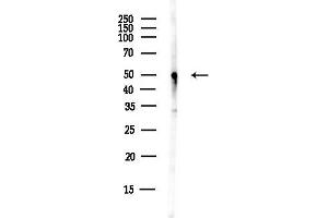 Western blot analysis of lysates from EC304 cells(heat-shock,45 min treatment), using Kv1.