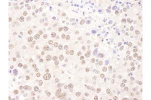 anti-Upstream Transcription Factor 2, C-Fos Interacting (USF2) (AA 150-200) antibody