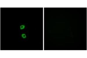Immunofluorescence analysis of MCF7 cells, using FZD7 Antibody. (FZD7 抗体  (AA 45-94))