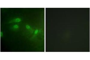 Immunofluorescence analysis of HeLa cells, using MDM2 (Phospho-Ser186+Ser188) Antibody. (MDM2 抗体  (pSer186))