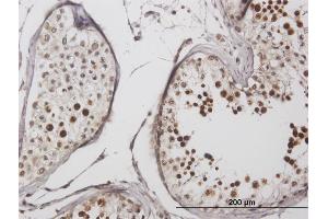 Immunoperoxidase of purified MaxPab antibody to LYAR on formalin-fixed paraffin-embedded human testis. (LYAR 抗体  (AA 1-379))