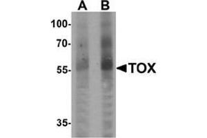 Western blot analysis of TOX in human colon tissue lysate with TOX Antibody  at (A) 1 and (B) 2 μg/ml. (TOX 抗体  (N-Term))