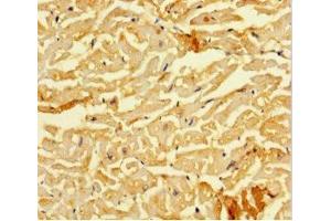 Immunohistochemistry of paraffin-embedded human heart tissue using ABIN7160220 at dilution of 1:100 (SMAD1 抗体  (AA 150-250))