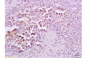 Formalin-fixed and paraffin embedded mouse lymphoma tissue labeled with Anti-FRA2/FOSL2 Polyclonal Antibody, Unconjugated (ABIN673104) at 1:200 followed by conjugation to the secondary antibody and DAB staining (FOSL2 抗体  (AA 231-326))