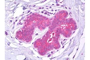 Anti-IST1 antibody IHC of human breast. (IST1 抗体)