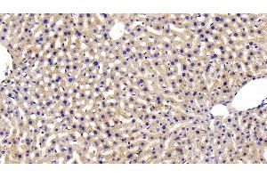 Detection of INSR in Mouse Liver Tissue using Polyclonal Antibody to Insulin Receptor (INSR) (Insulin Receptor 抗体  (AA 1101-1372))
