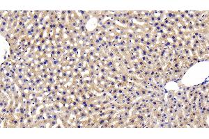 Detection of INSR in Mouse Liver Tissue using Polyclonal Antibody to Insulin Receptor (INSR)