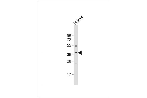 OR3A2 抗体  (C-Term)