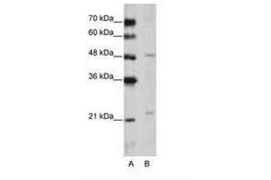 Image no. 1 for anti-WD Repeat Domain 12 (WDR12) (C-Term) antibody (ABIN202489) (WDR12 抗体  (C-Term))