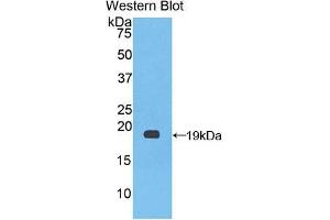 Western blot analysis of the recombinant protein. (Factor VIII 抗体  (AA 1887-2044))