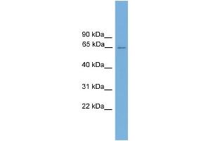 WB Suggested Anti-CARD9 Antibody Titration: 0. (CARD9 抗体  (Middle Region))