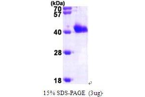 GIPC PDZ Domain Containing Family, Member 1 (GIPC1) (AA 1-333) protein (His tag)
