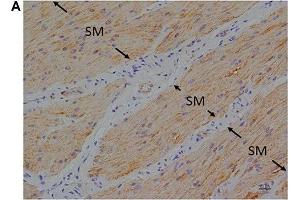 Immunohistochemistry (IHC) image for anti-omega-3 Fatty Acid Receptor 1 (O3FAR1) (N-Term) antibody (ABIN2854731)