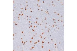 Immunohistochemistry (IHC) image for anti-Histone 3 (H3) (H3K27me) antibody (ABIN6219521)