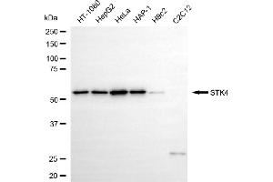 anti-serine/threonine Kinase 4 (STK4) antibody