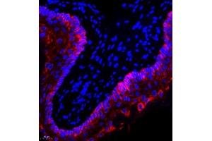 Immunofluorescence of paraffin embedded rat esophagus using CK13 (ABIN7074412) at dilution of 1:1500 (400x lens) (Cytokeratin 13 抗体  (N-Term))