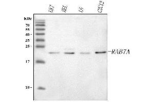 Western blot analysis of RAB7A using anti-RAB7A antibody (ABIN7600153).
