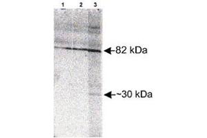 Western blot analysis of Scarb2 in Jurkat whole cell lysate with Scarb2 polyclonal antibody  at different concentration : Lane 1, 1 : 1000. (SCARB2 抗体)