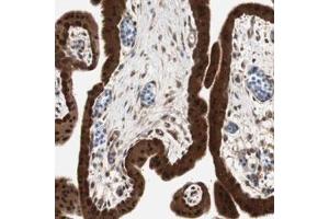 Immunohistochemical staining (Formalin-fixed paraffin-embedded sections) of human placenta with GALT polyclonal antibody  shows strong nuclear and cytoplasmic positivity in trophoblastic cells.