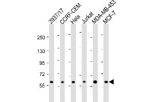 All lanes : Anti-RNF31 Antibody (C-term) at 1:2000 dilution Lane 1: 293T/17 whole cell lysate Lane 2: CCRF-CEM whole cell lysate Lane 3: Hela whole cell lysate Lane 4: Jurkat whole cell lysate Lane 5: MDA-MB-453 whole cell lysate Lane 6: MCF-7 whole cell lysate Lysates/proteins at 20 μg per lane. (RNF31 抗体  (C-Term))