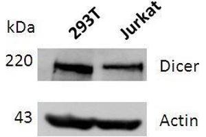 Western blot analysis of DICER expression in lysates of 293T and Jurkat cells. (DICER1 抗体  (full length))