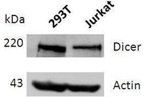 Western Blotting (WB) image for anti-Dicer 1, Ribonuclease Type III (DICER1) (full length) antibody (ABIN2443900)