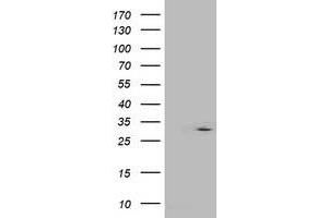 Western Blotting (WB) image for anti-Interferon-Induced Protein 35 (IFI35) antibody (ABIN1498801) (IFI35 抗体)