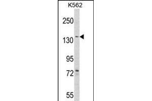 Western blot analysis of hAGL- (ABIN1882062 and ABIN2839246) in K562 cell line lysates (35 μg/lane). (AGL 抗体  (AA 357-387))