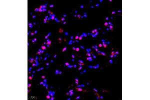 Immunofluorescence of paraffin embedded human lung using TFIIIC110 (ABIN7074038) at dilution of 1:650 (400x lens) (GTF3C2 抗体)