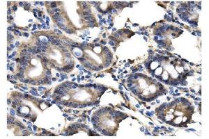 IHC analysis of Clathrin heavy chain/CLTC using anti-Clathrin heavy chain/CLTC antibody (ABIN7602704). (Clathrin Heavy Chain (CLTC) (AA 967-1668) 抗体)